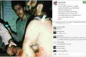 جانبازان جانبازان